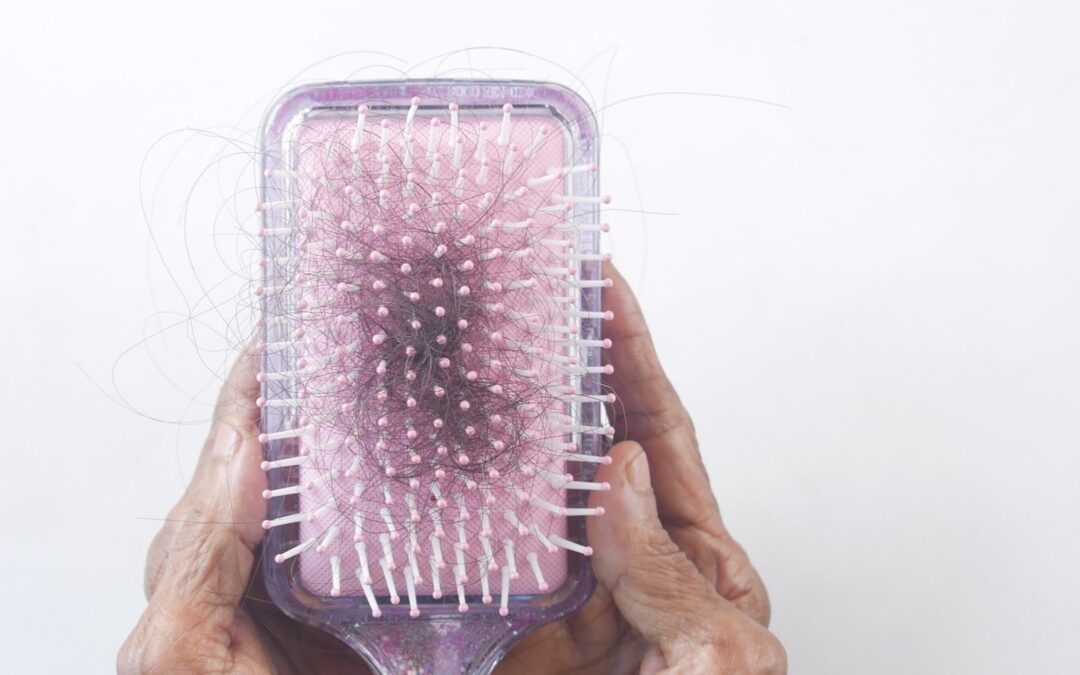 Low Thyroid And Hair Loss